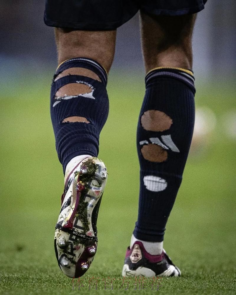 贝林穿破洞球袜属于违规 但因健康因素放宽限制